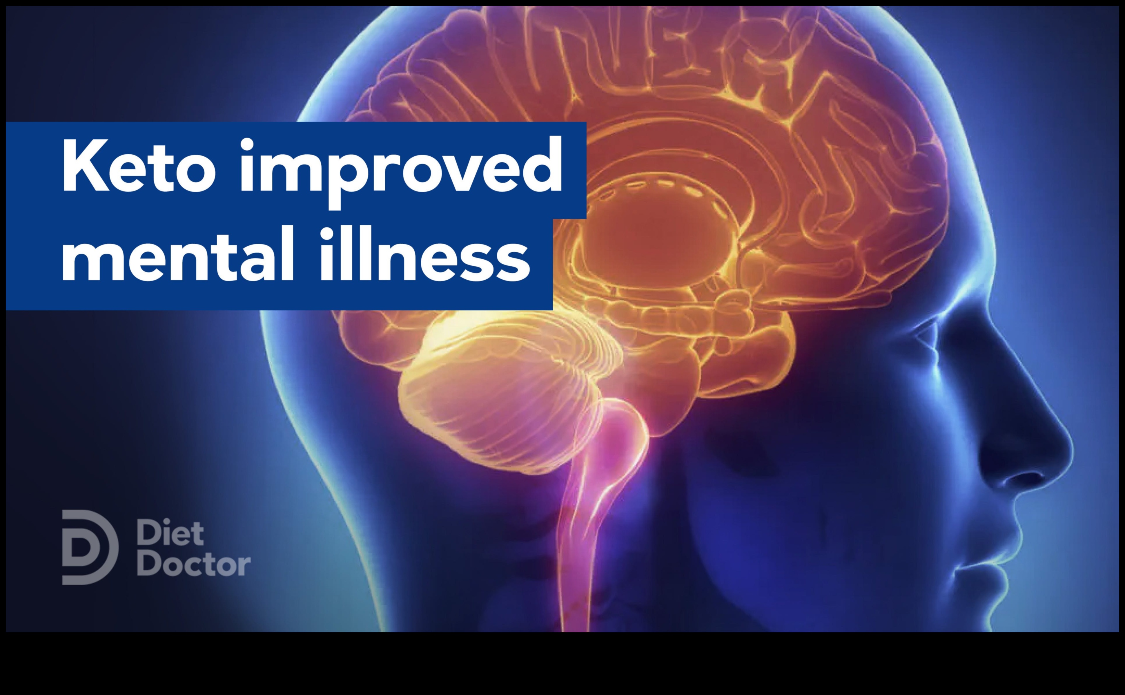 כיצד דיאטת קטו יכולה לשפר את בריאותך הנפשית 5 הקשר בין קטו לחוסן נפשי